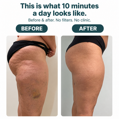 CELIVO® ELITE Lymphatic Roller